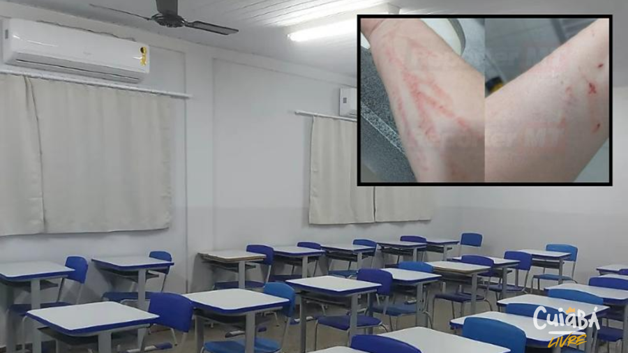 Aluno com autismo agride professora e foge de escola em Várzea Grande
